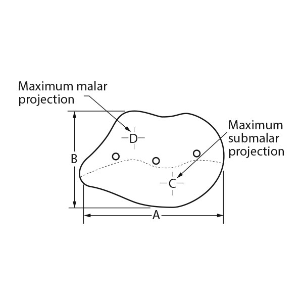Combined Submalar Shell™ Combined Submalar Shell™