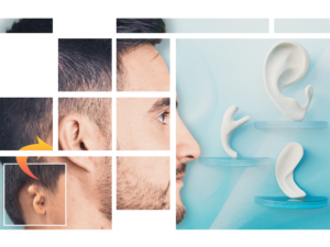 Composite™ Auricular Implants