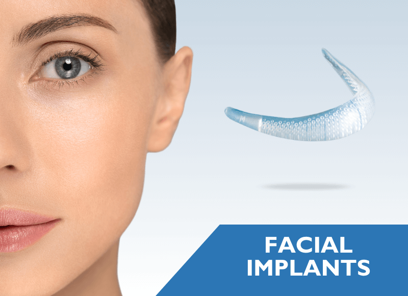 Facial Implants
