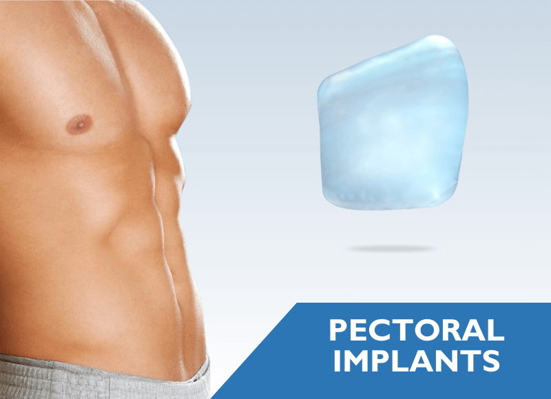 Pectoral Implants